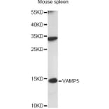 Western Blot - Anti-VAMP5 Antibody (A14371) - Antibodies.com