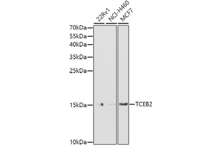 Western Blot - Anti-TCEB2/Elongin-B Antibody (A88455) - Antibodies.com
