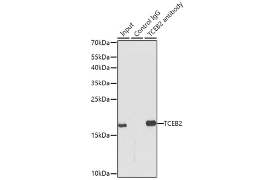 Western Blot - Anti-TCEB2/Elongin-B Antibody (A88455) - Antibodies.com