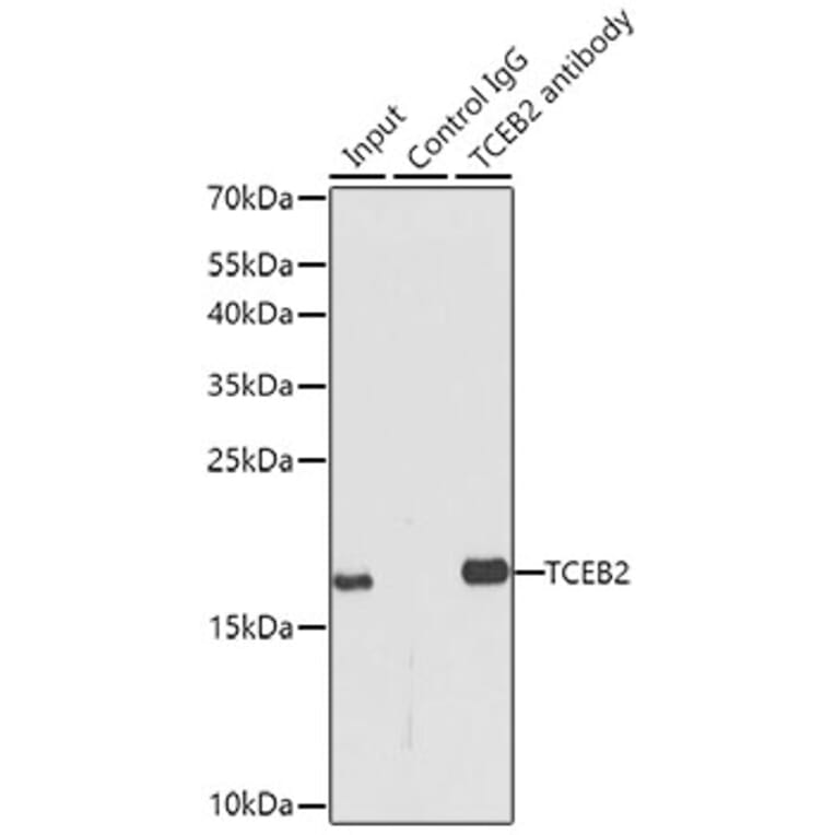 Western Blot - Anti-TCEB2/Elongin-B Antibody (A88455) - Antibodies.com