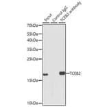 Western Blot - Anti-TCEB2/Elongin-B Antibody (A88455) - Antibodies.com