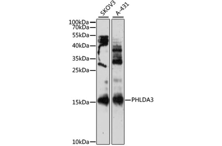 Western Blot - Anti-PHLDA3 Antibody (A12666) - Antibodies.com