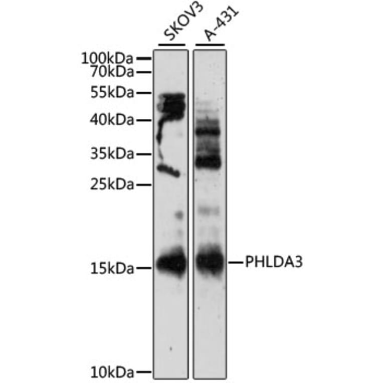 Western Blot - Anti-PHLDA3 Antibody (A12666) - Antibodies.com