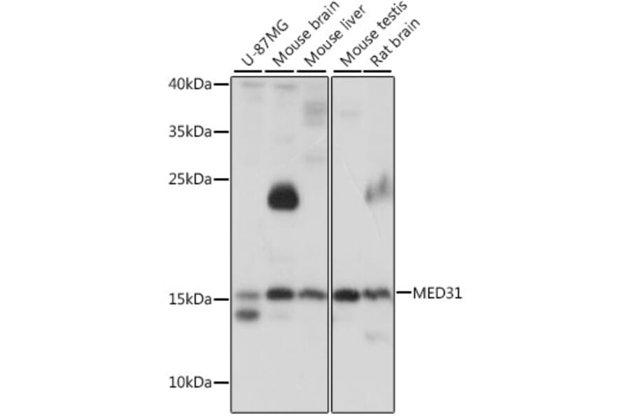 Western Blot - Anti-MED31 Antibody (A15831) - Antibodies.com