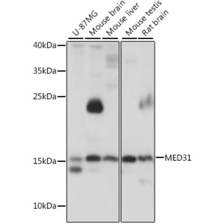 Western Blot - Anti-MED31 Antibody (A15831) - Antibodies.com
