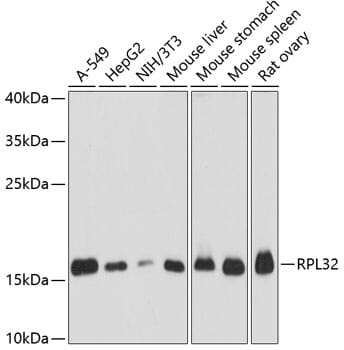 Western blot analysis of extracts of various cell lines, using Anti-RPL32 Antibody (A13001) at 1:3000 dilution.
Secondary antibody: Goat Anti-Rabbit IgG (H+L) (HRP) (AS014) at 1:10,000 dilution.
Lysates / proteins: 25µg per lane.
Blocking buffer: 3% non-fat dry milk in TBST.
Detection: ECL Basic Kit (RM00020).
Exposure time: 1s.