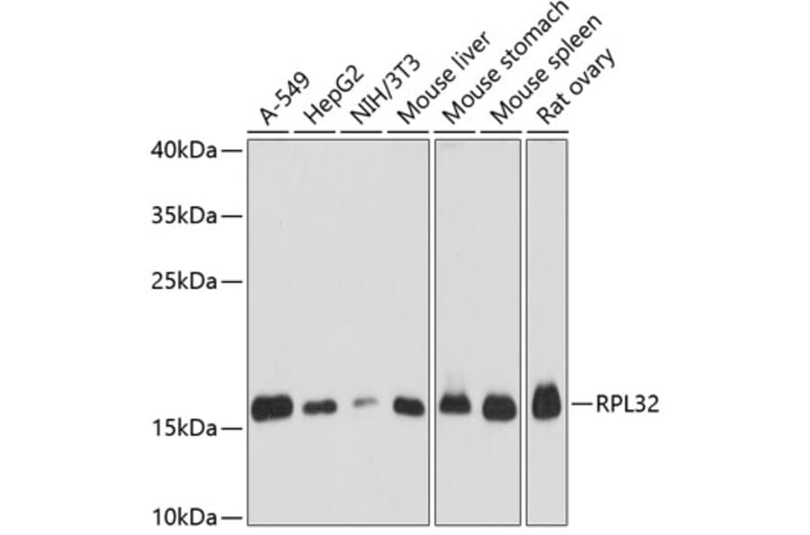 Western Blot - Anti-RPL32 Antibody (A88458) - Antibodies.com