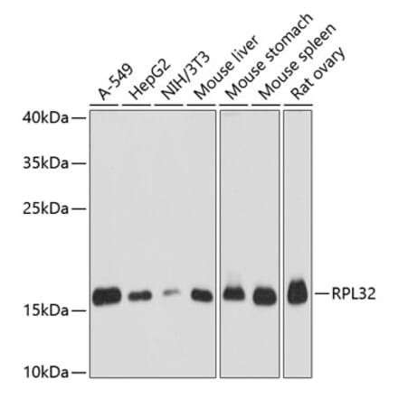 Western Blot - Anti-RPL32 Antibody (A88458) - Antibodies.com