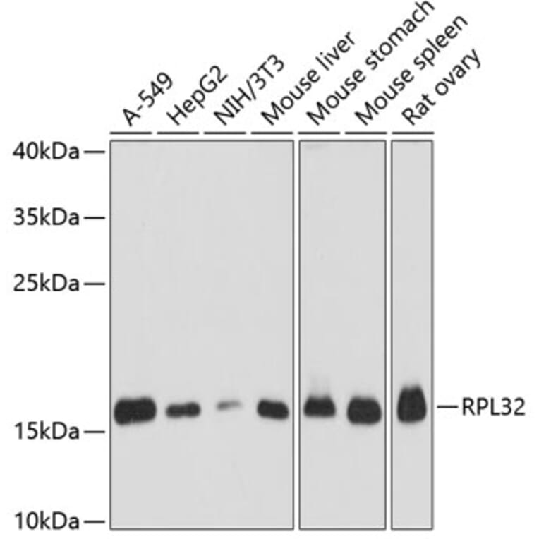 Western Blot - Anti-RPL32 Antibody (A88458) - Antibodies.com