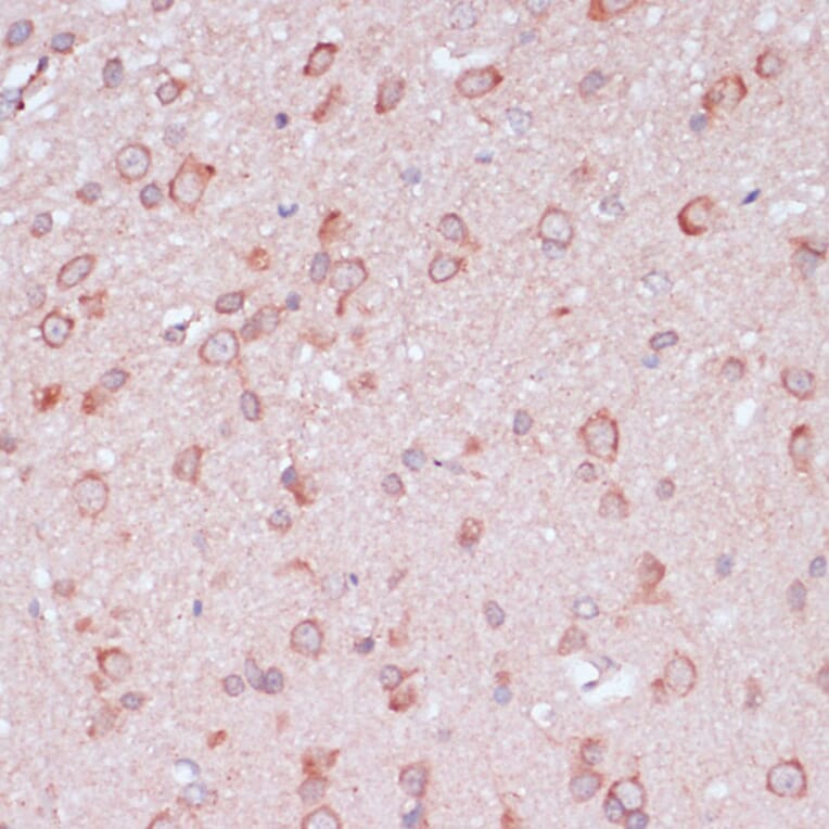 Immunohistochemistry - Anti-RPL32 Antibody (A88458) - Antibodies.com