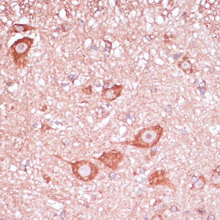 Immunohistochemistry - Anti-RPL32 Antibody (A88458) - Antibodies.com