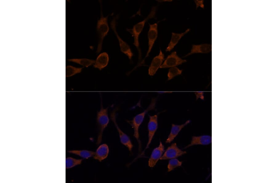 Immunofluorescence - Anti-RPL32 Antibody (A88458) - Antibodies.com