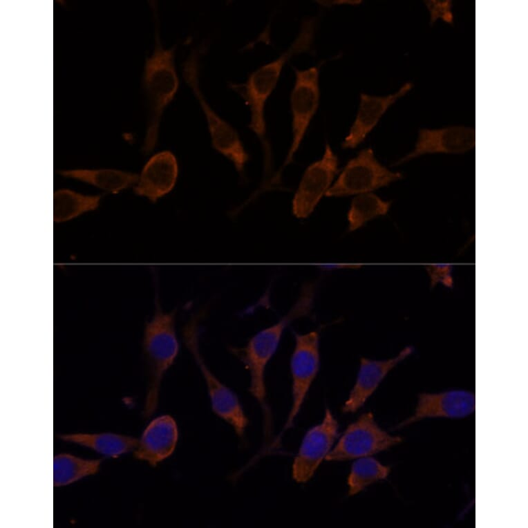 Immunofluorescence - Anti-RPL32 Antibody (A88458) - Antibodies.com