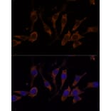 Immunofluorescence - Anti-RPL32 Antibody (A88458) - Antibodies.com