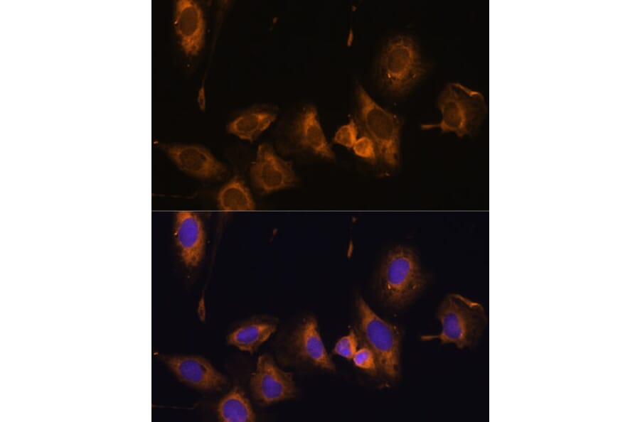 Immunofluorescence - Anti-RPL32 Antibody (A88458) - Antibodies.com