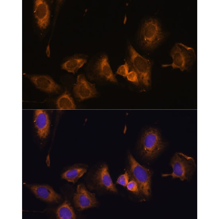 Immunofluorescence - Anti-RPL32 Antibody (A88458) - Antibodies.com