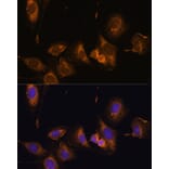 Immunofluorescence - Anti-RPL32 Antibody (A88458) - Antibodies.com