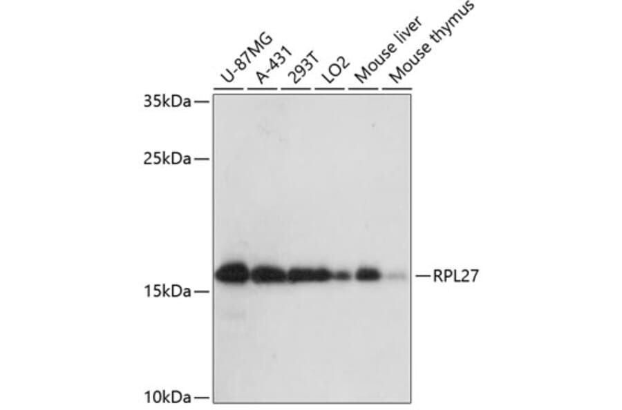 Western Blot - Anti-RPL27/RPL27A Antibody (A88460) - Antibodies.com