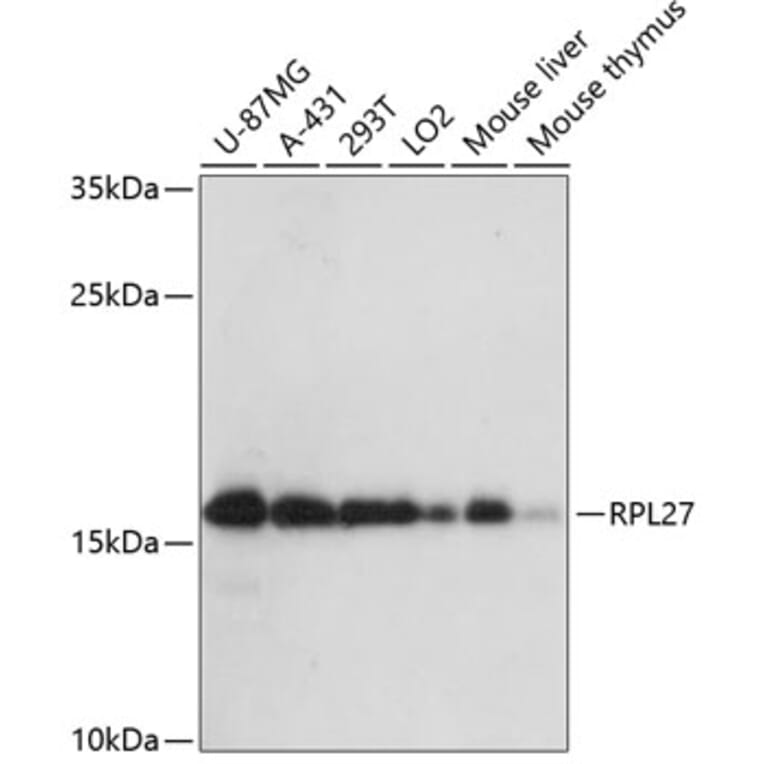 Western Blot - Anti-RPL27/RPL27A Antibody (A88460) - Antibodies.com