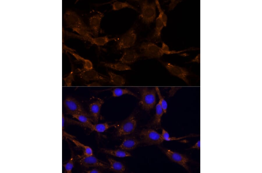 Immunofluorescence - Anti-RPL27/RPL27A Antibody (A88460) - Antibodies.com