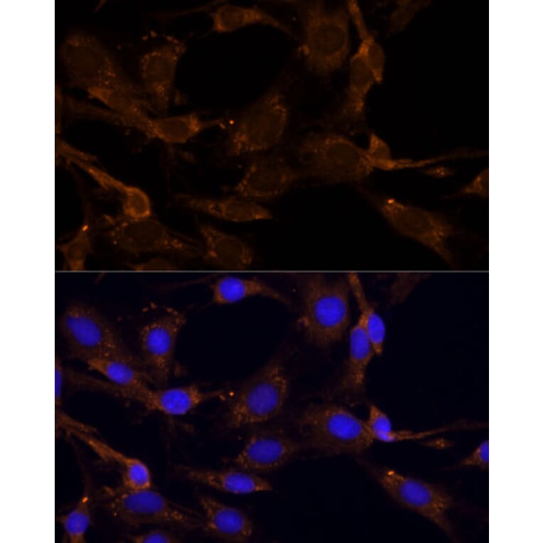 Immunofluorescence - Anti-RPL27/RPL27A Antibody (A88460) - Antibodies.com