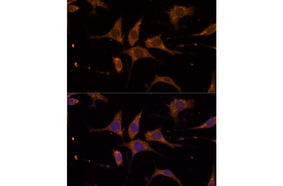 Immunofluorescence - Anti-RPL27/RPL27A Antibody (A88460) - Antibodies.com