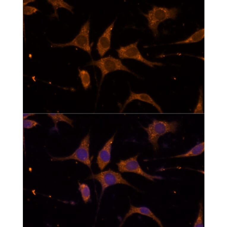 Immunofluorescence - Anti-RPL27/RPL27A Antibody (A88460) - Antibodies.com