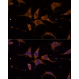 Immunofluorescence - Anti-RPL27/RPL27A Antibody (A88460) - Antibodies.com