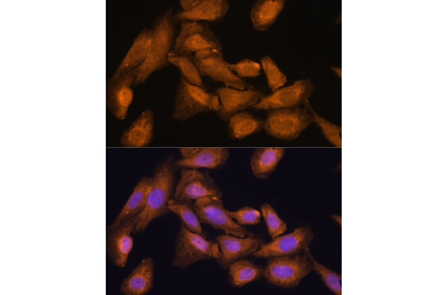 Immunofluorescence - Anti-RPL27/RPL27A Antibody (A88460) - Antibodies.com