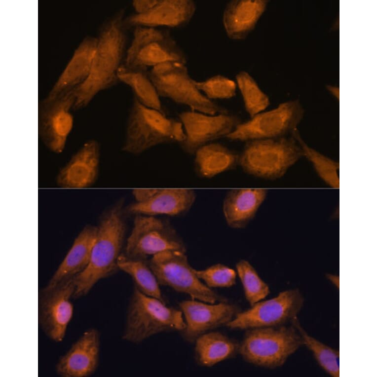 Immunofluorescence - Anti-RPL27/RPL27A Antibody (A88460) - Antibodies.com