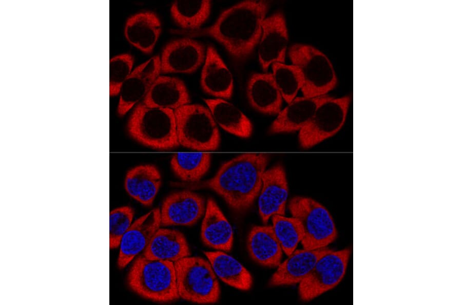 Immunofluorescence - Anti-RPL27/RPL27A Antibody (A88460) - Antibodies.com