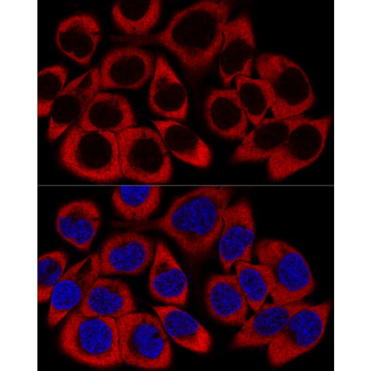 Immunofluorescence - Anti-RPL27/RPL27A Antibody (A88460) - Antibodies.com