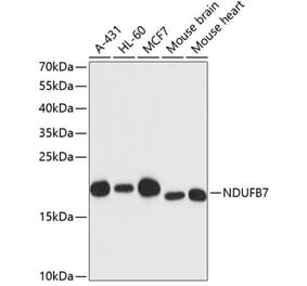 Western Blot - Anti-NDUFB7 Antibody (A88461) - Antibodies.com