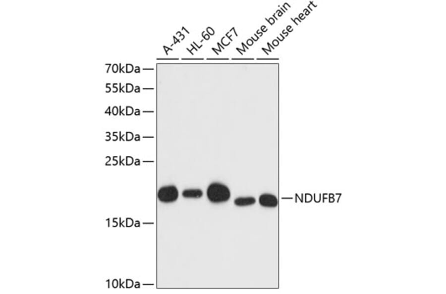 Western Blot - Anti-NDUFB7 Antibody (A88461) - Antibodies.com