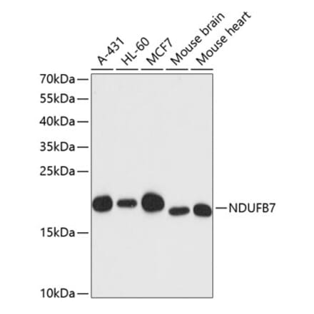 Western Blot - Anti-NDUFB7 Antibody (A88461) - Antibodies.com