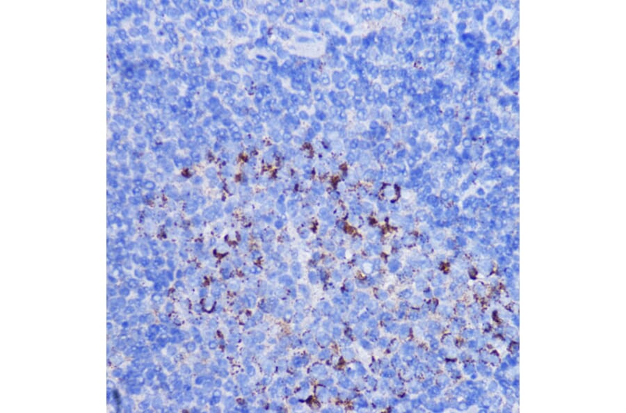 Immunohistochemistry - Anti-NDUFB7 Antibody (A88461) - Antibodies.com
