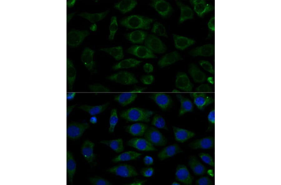Immunofluorescence - Anti-NDUFB7 Antibody (A88461) - Antibodies.com