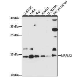 Western Blot - Anti-MRPL42 Antibody (A88462) - Antibodies.com