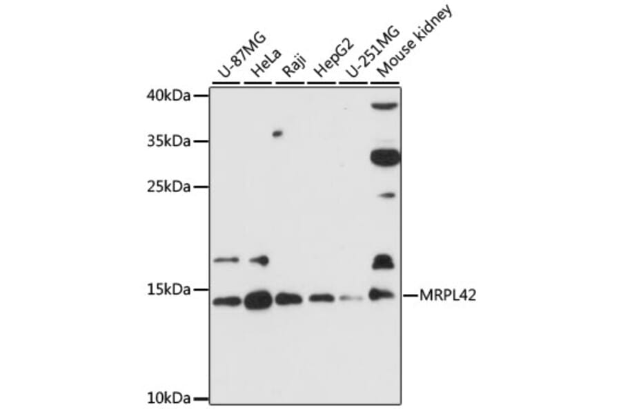 Western Blot - Anti-MRPL42 Antibody (A88462) - Antibodies.com