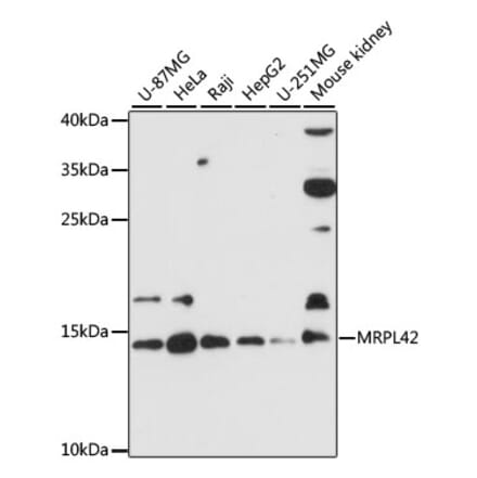 Western Blot - Anti-MRPL42 Antibody (A88462) - Antibodies.com