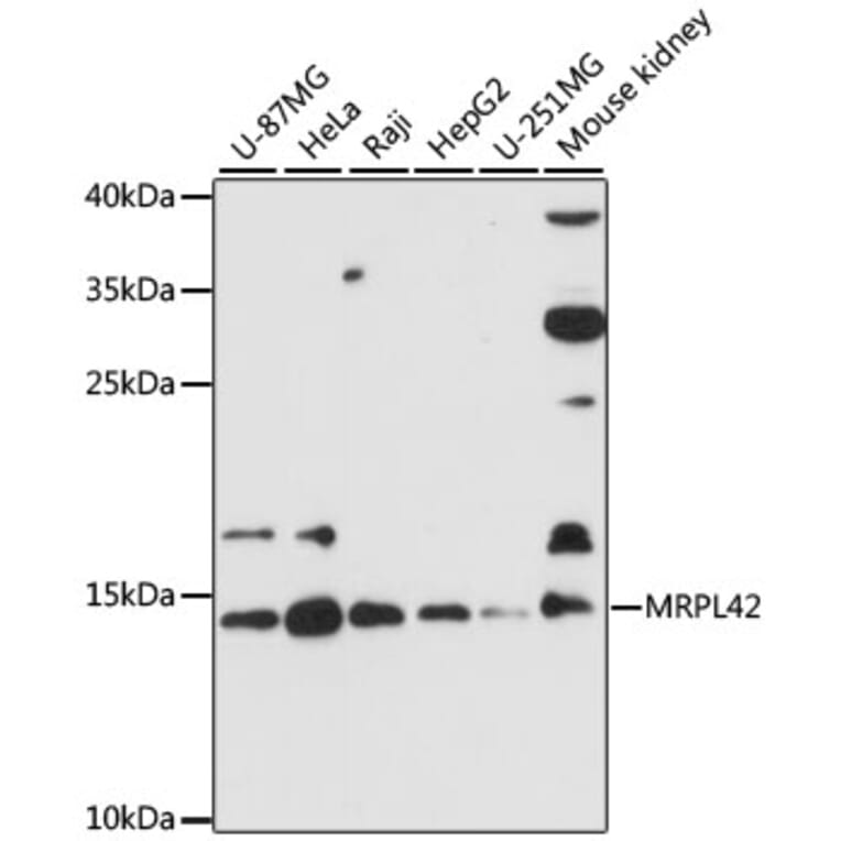 Western Blot - Anti-MRPL42 Antibody (A88462) - Antibodies.com