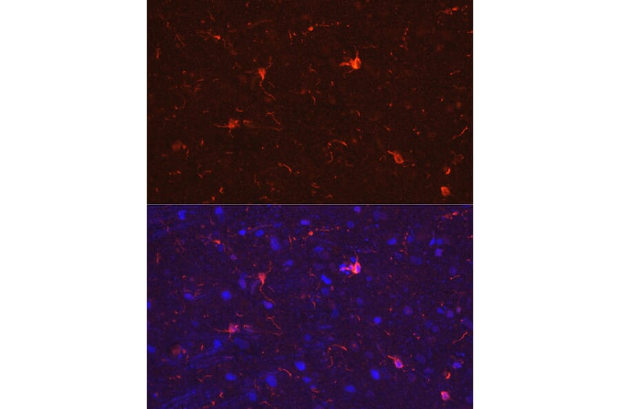 Immunofluorescence - Anti-Iba1 Antibody (A88463) - Antibodies.com