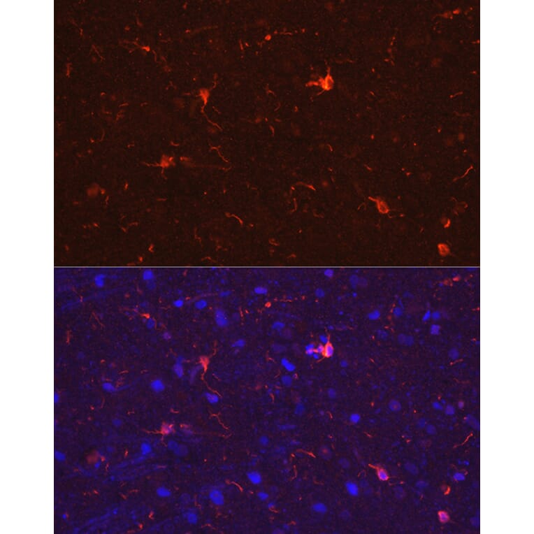 Immunofluorescence - Anti-Iba1 Antibody (A88463) - Antibodies.com