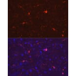 Immunofluorescence - Anti-Iba1 Antibody (A88463) - Antibodies.com