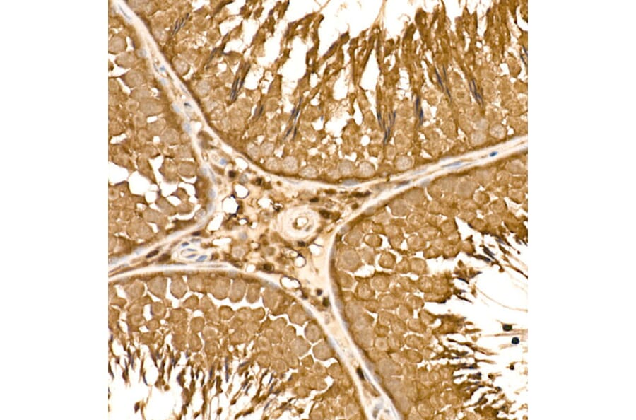 Immunohistochemistry - Anti-HN1 Antibody (A88464) - Antibodies.com