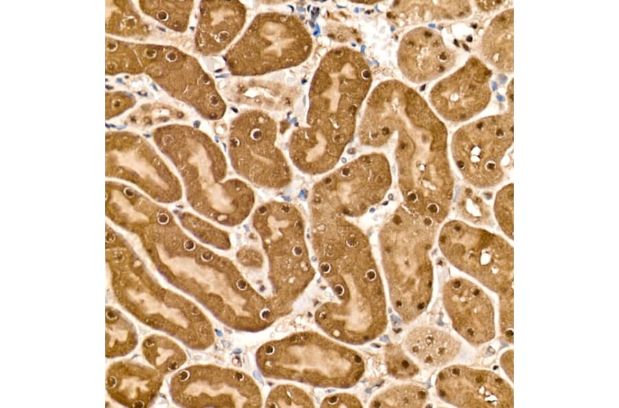 Immunohistochemistry - Anti-HN1 Antibody (A88464) - Antibodies.com
