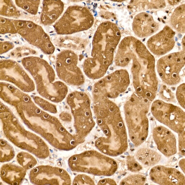 Immunohistochemistry - Anti-HN1 Antibody (A88464) - Antibodies.com
