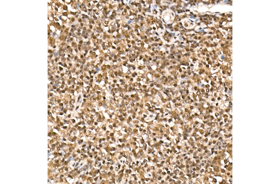Immunohistochemistry - Anti-HN1 Antibody (A88464) - Antibodies.com