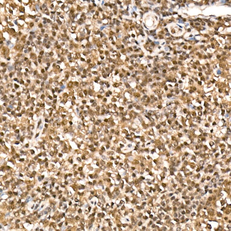 Immunohistochemistry - Anti-HN1 Antibody (A88464) - Antibodies.com