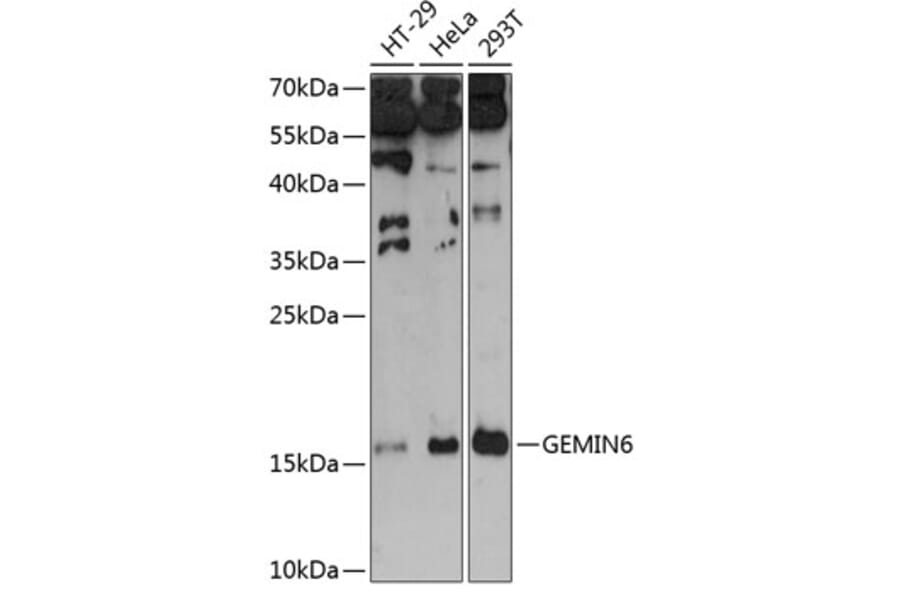 Western Blot - Anti-Gemin6/SIP2 Antibody (A88465) - Antibodies.com